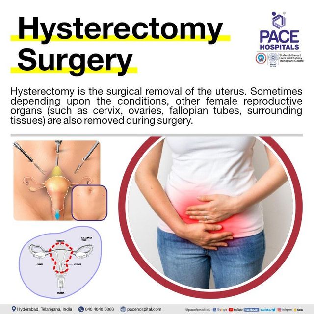 Understanding Hysterectomy: Procedure and Health Conditions Understanding Hysterectomy: Procedure and Health Conditions